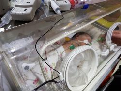 A two-day-old baby born to Syrian refugee parents in Cyprus flown to Israel for heart surgery